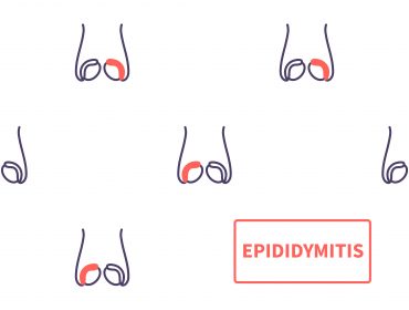 can you get epididymitis without having an std